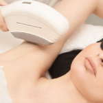 Best Laser Hair Removal for Asian Skin in Annandale, VA