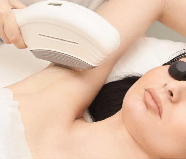 Best Laser Hair Removal for Asian Skin in Annandale, VA