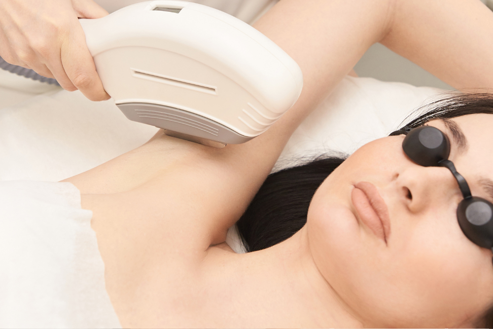 Best Laser Hair Removal for Asian Skin in Annandale, VA