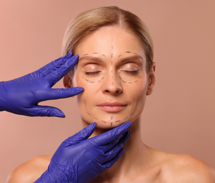 Top Facelift Surgery Providers Near Leesburg, VA