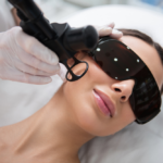 What Are the Top Advanced Laser Facial Treatments in McLean, VA for Radiant Skin?