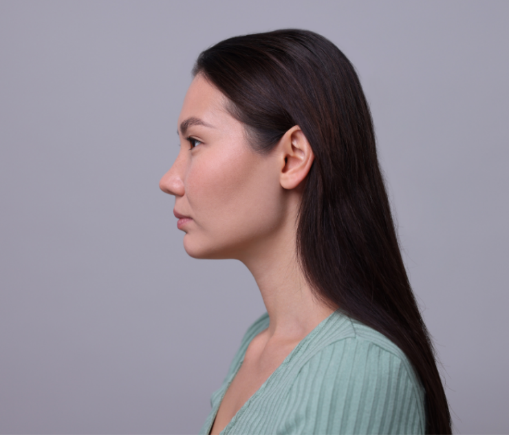 Ethnic Rhinoplasty Expertise in Leesburg, VA