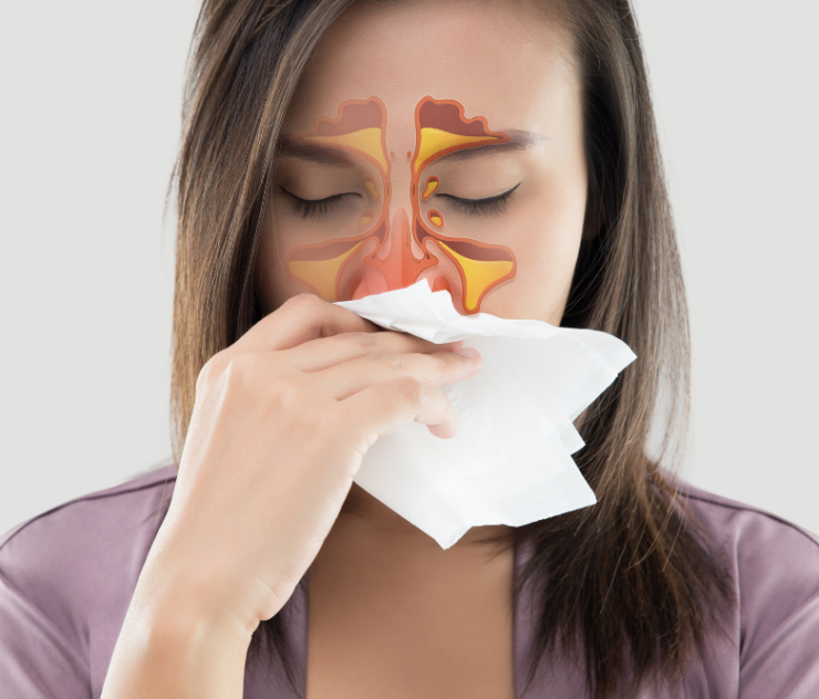 Recognizing Sinusitis Symptoms and When to Seek Treatment Near Tysons Corner VA