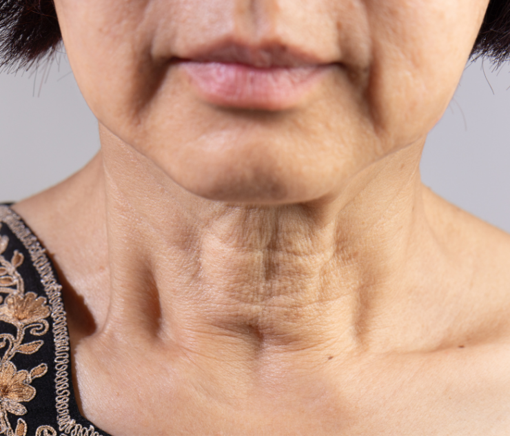 Advanced Neck Lift Procedures in Purcellville, VA