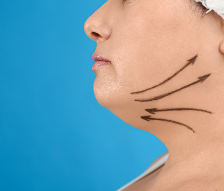 Choosing the Top Neck Lift Surgery Specialists in Ashburn, VA