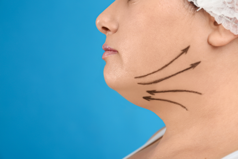 Choosing the Top Neck Lift Surgery Specialists in Ashburn, VA